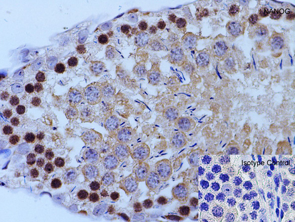 Immunohistochemistry of NANOG