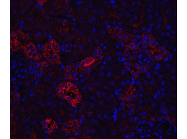 Immunofluorescence Validation of Nephrin