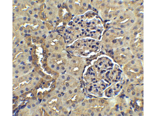 Immunohistochemistry Validation of Nephrin