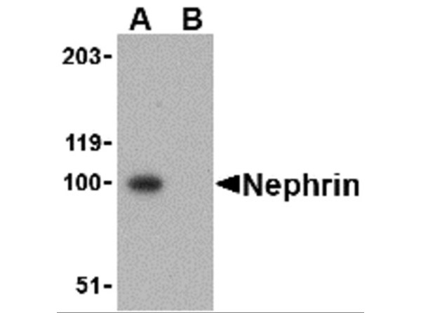 Western Blot Validation of Nephrin