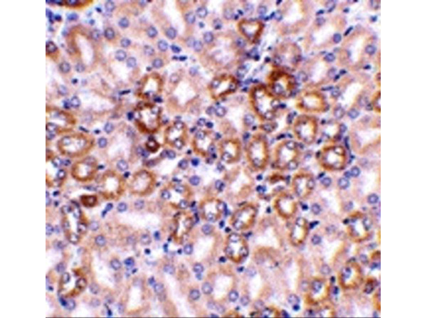 Immunohistochemistry Validation of Nephrin