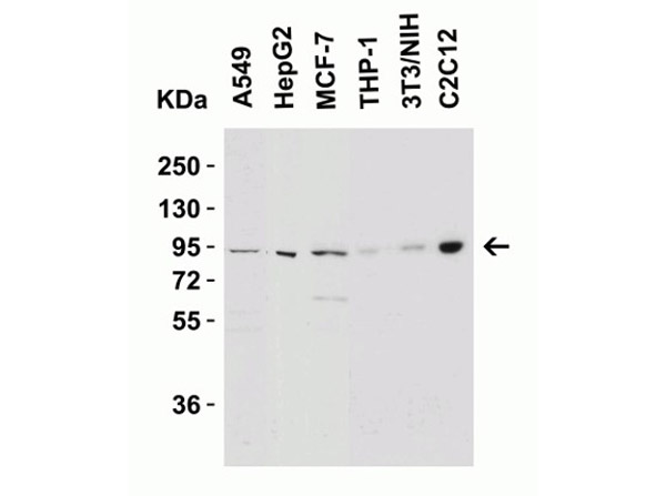 Western Blot Validation of Nephrin