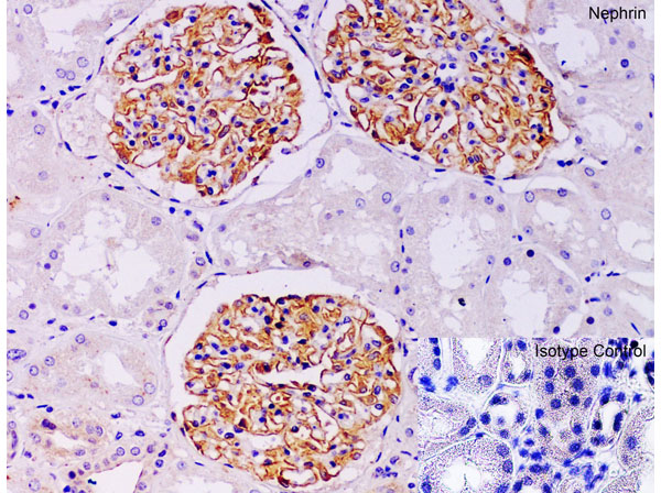 Immunohistochemistry of Nephrin