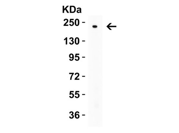 Western Blot of Nephrin