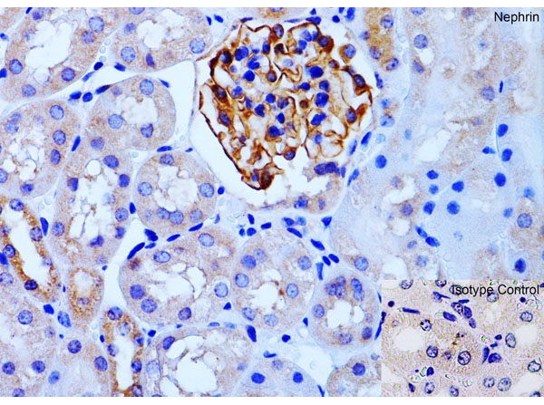 Immunohistochemistry of Nephrin