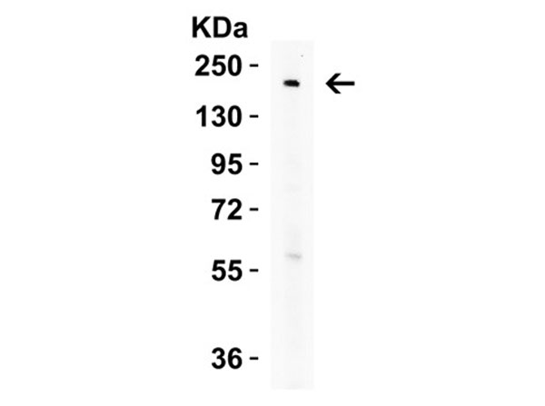 Western Blot of Nephrin