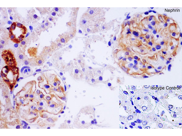 Immunohistochemistry of Nephrin