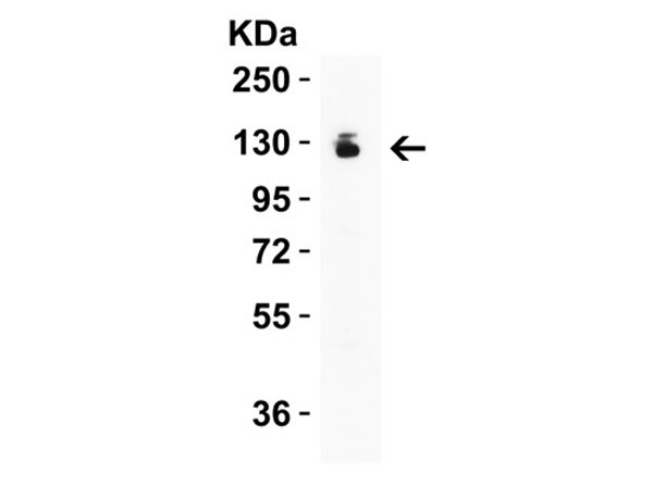 Western Blot of Nephrin