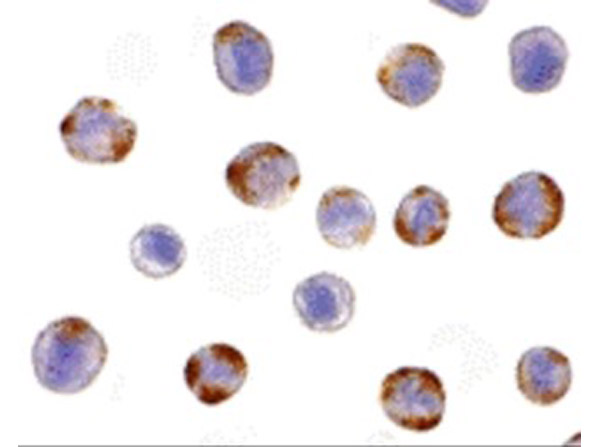 Immunocytochemistry of NOD2