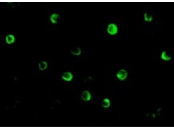 Immunofluorescence of NOD2