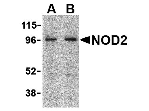 Western blot analysis of NOD2