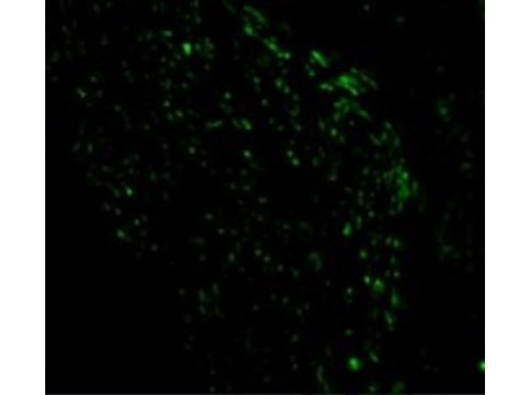 Immunofluorescence of NOXA