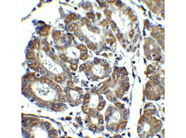 Immunohistochemistry of NOXA