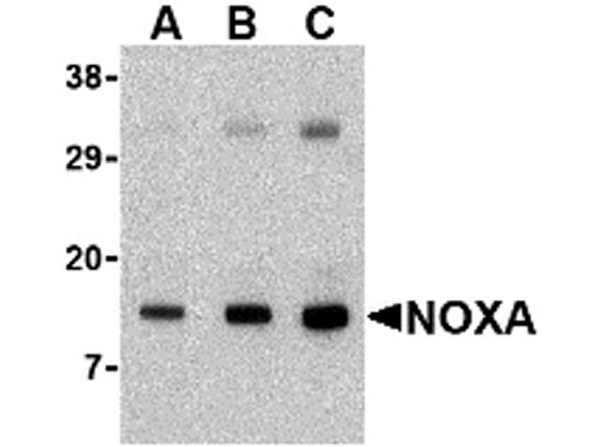 Western blot of NOXA