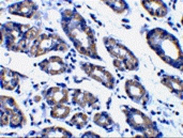 Immunohistochemistry of NOXA