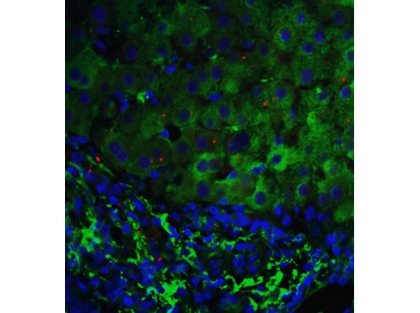 Immunofluorescence of p53DINP1