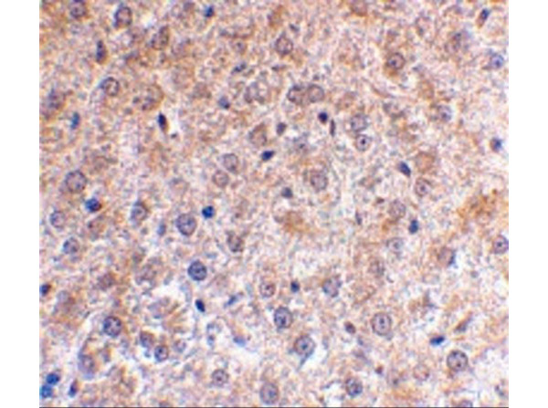 Immunohistochemistry of p53DINP1