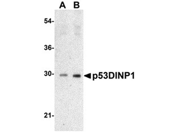 Western blot of p53DINP1