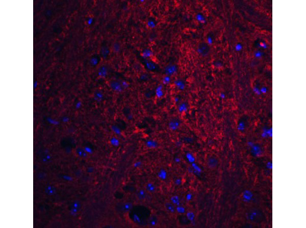 Immunofluorescence of PION