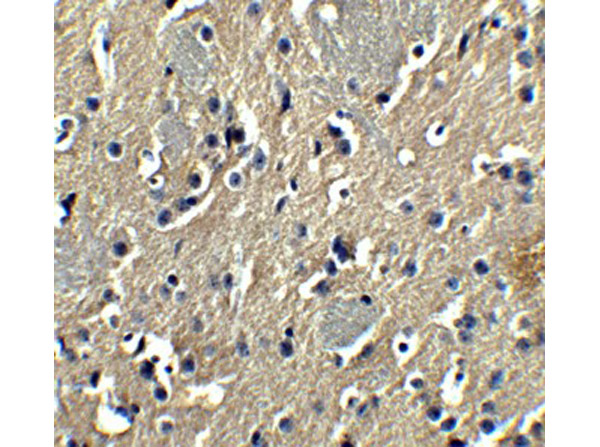 Immunohistochemistry of PION