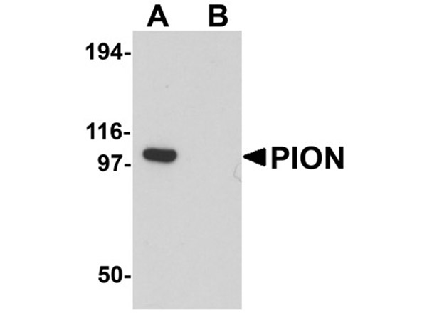 Western blot analysis of PION