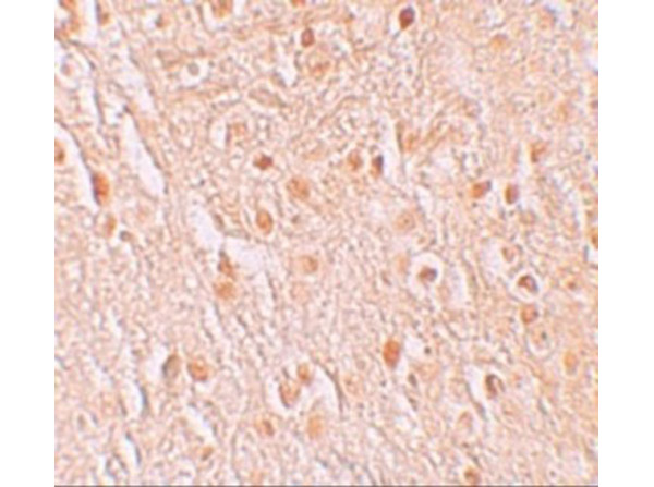 Immunohistochemistry of PION