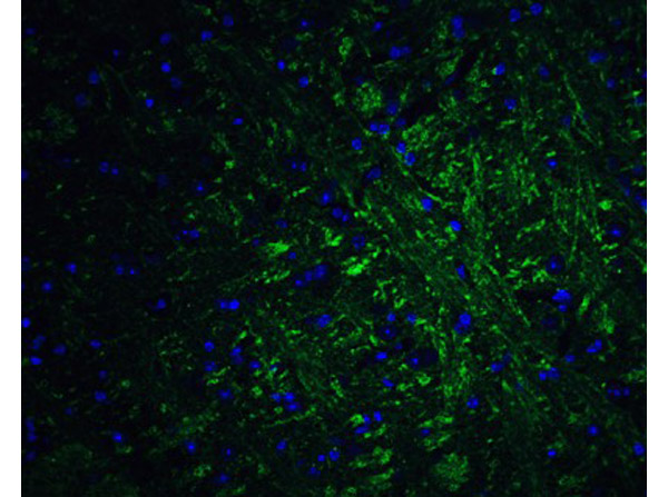 Immunofluorescence of PRDM16