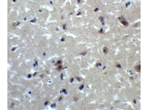 Immunohistochemistry of PRDM16