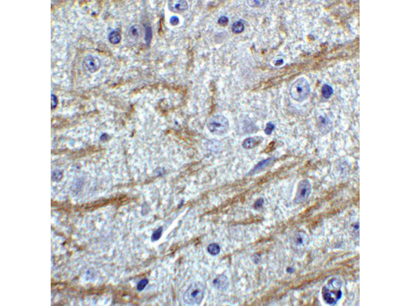 Immunohistochemistry of PRDM16