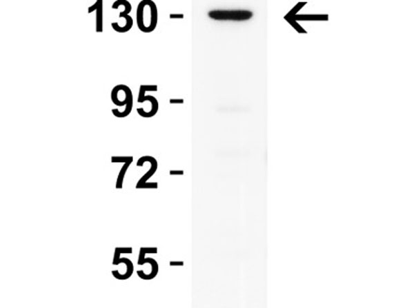 Western Blot of PRDM16