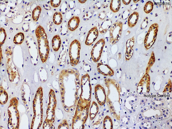 Immunohistochemistry of PRDM16