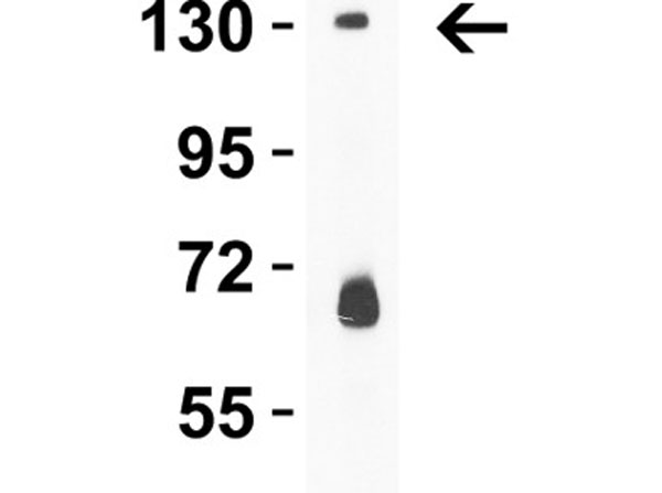 Western Blot of PRDM16
