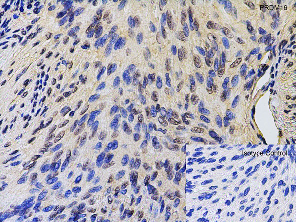 Immunohistochemistry of PRDM16