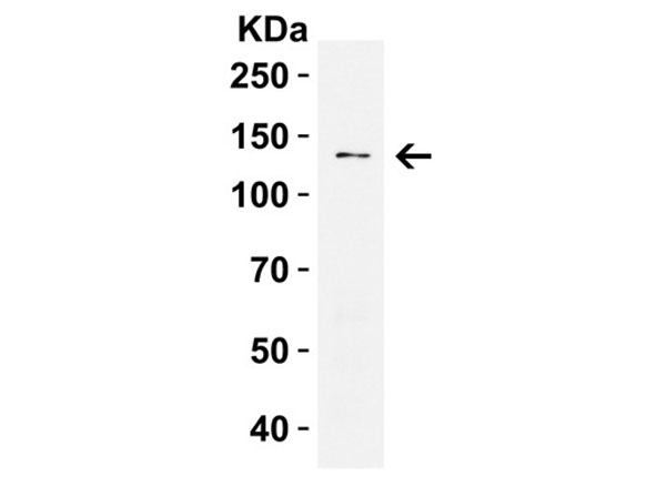 Western Blot of PRDM16