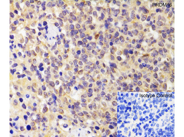 Immunohistochemistry of PRDM16