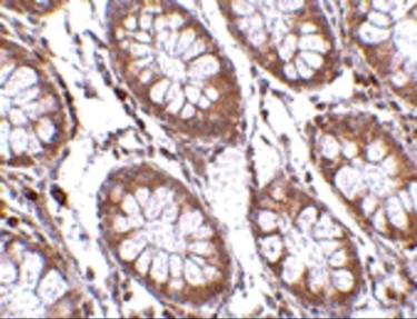 Immunohistochemistry of PTK7