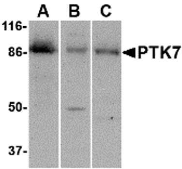 Western blot of PTK7