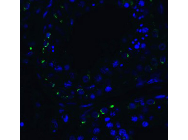 Immunofluorescence of RIG-1