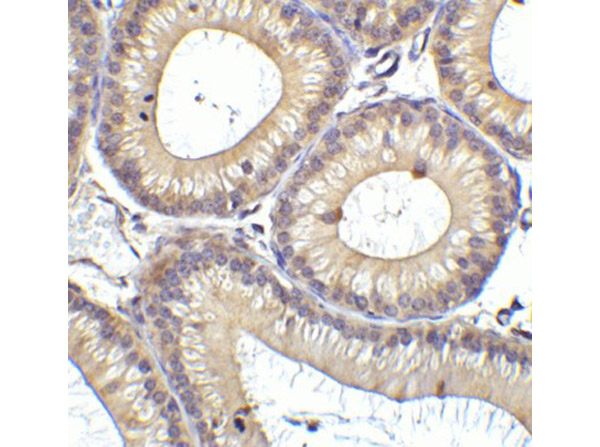 Immunohistochemistry of RIG-1