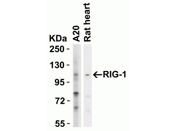 Western blot of RIG-1