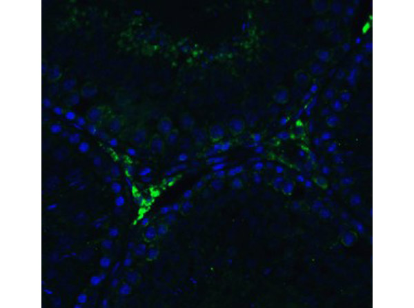 Immunofluorescence of RIG-1