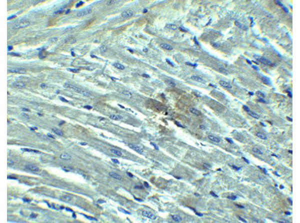 Immunohistochemistry of RIG-1