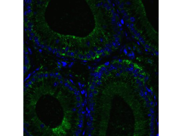 Immunofluorescence of RIG-1