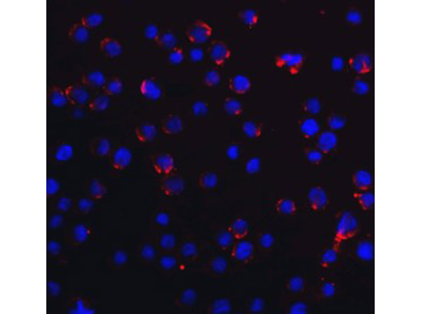 Immunofluorescence of RIG-1