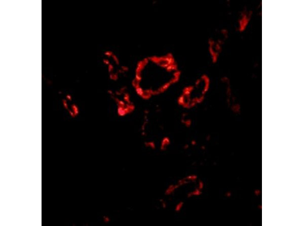 Immunofluorescence of Slug