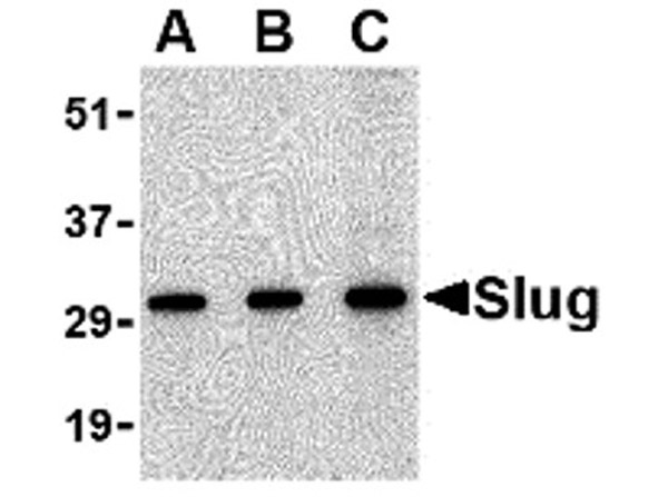 Western blot of Slug