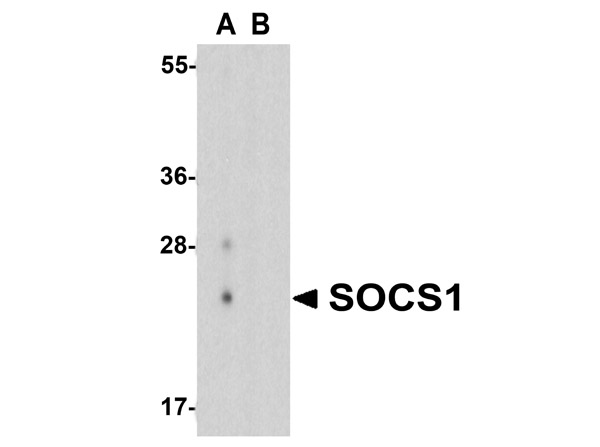 Western blot analysis of SOCS1