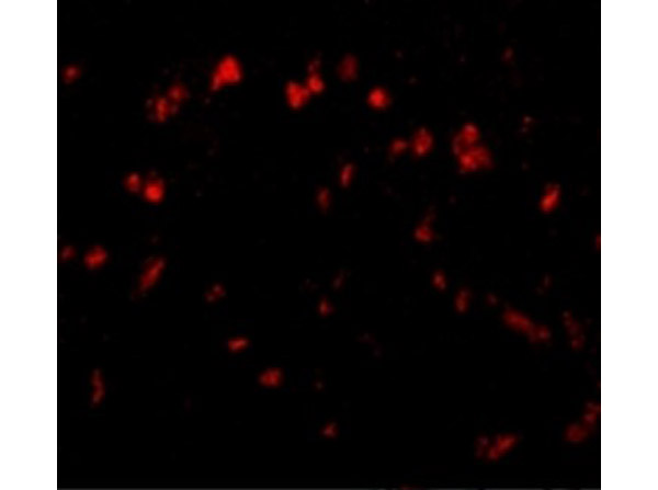 Immunofluorescence of Spred1