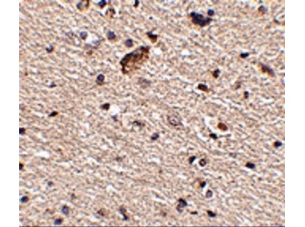 Immunohistochemistry of Spred1