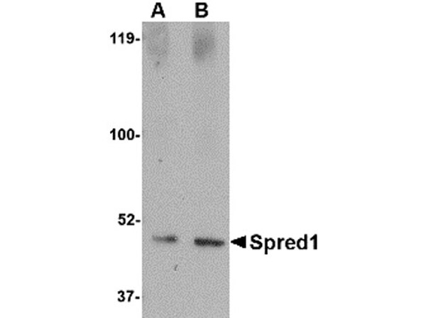 Western blot of Spred1